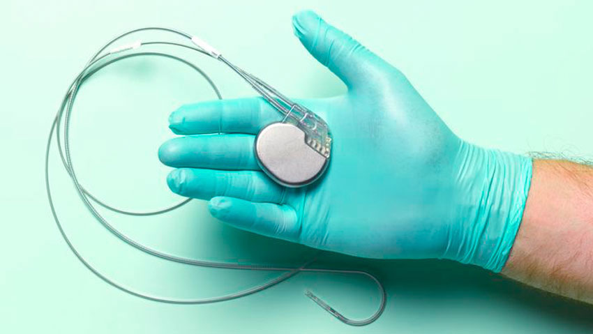 Reasons for Pacemaker Implantation