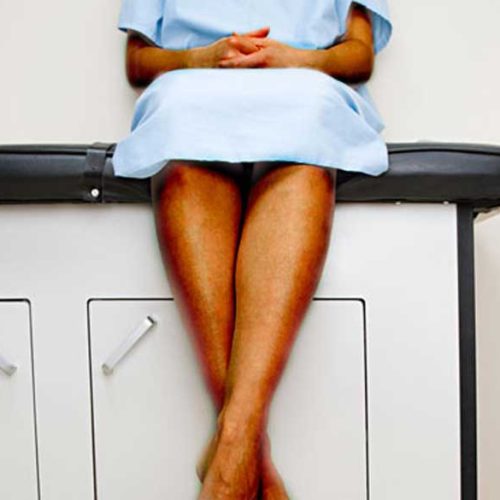 Uterine Fibroid Embolization