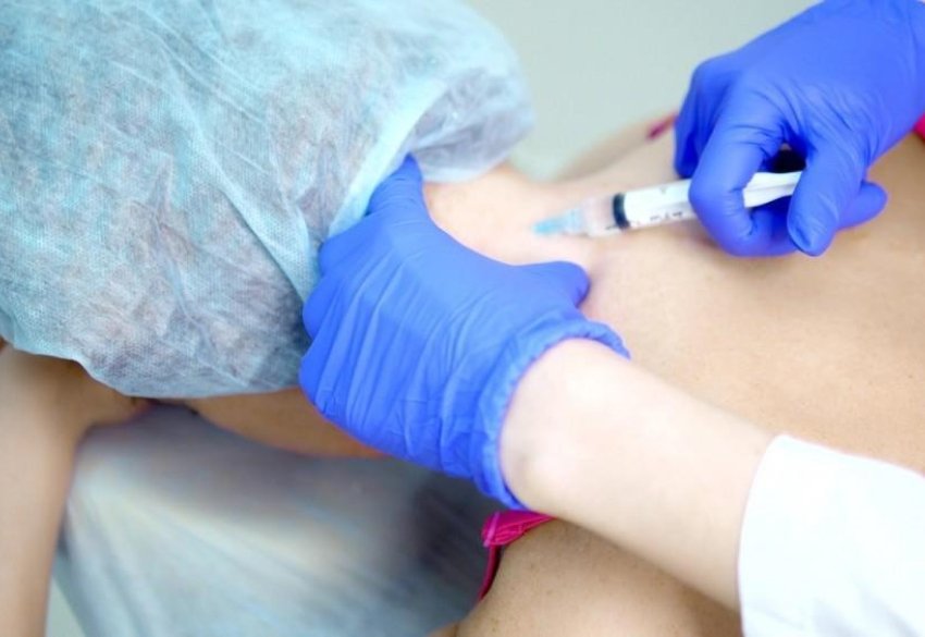 Epidural and Pain Management during Delivery